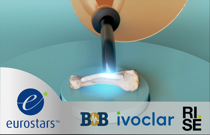 Biomedical Bonding AB secures Eurostars funding for its light-cured implants for the treatment of bone fractures